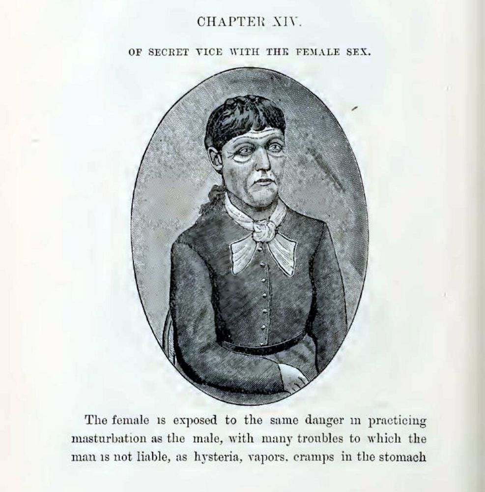 "Chapter XIV: of secret vice with the female sex." [Picture of someone. I don't know how to describe it.] "The female is exposed to the same danger in practicing masturbation as the male, with many troubles to which the man is not liable, as hysteria, vapors, cramps in the stomach..."]