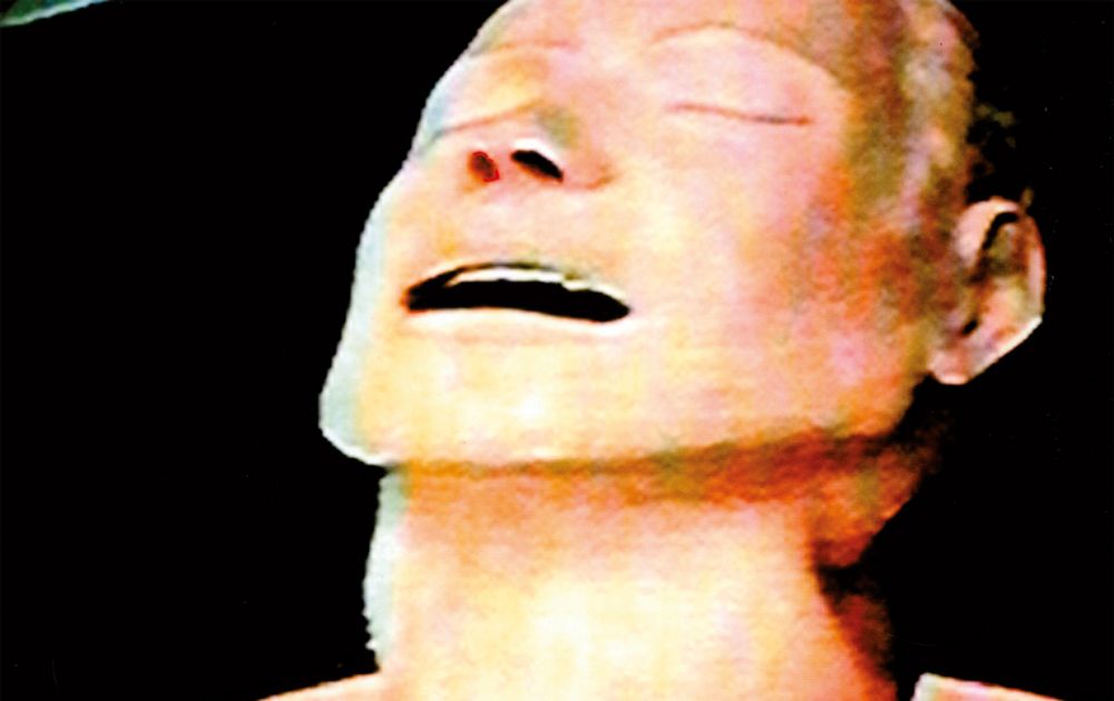 A man tilting his head back, mouth open, eyes closed, looking relaxed. It is also the album cover for the Radiohead album The Bends.