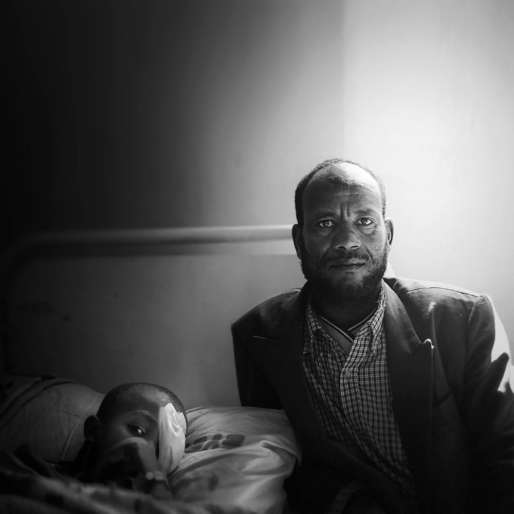 A father sits by his child’s hospital bed. The child rests with an eye patch, The man looks straight at the camera — strong, weary, and unmoved by pity. It’s a portrait of endurance in the face of pain.