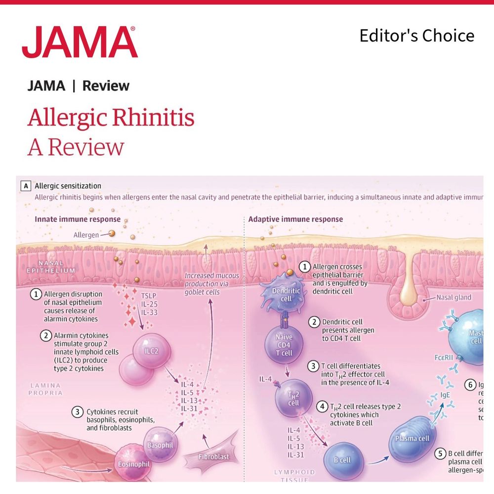 Diagram illustrating allergic rhinitis, starting with allergen entry into the nasal cavity, leading to innate and adaptive immune responses, involving cells like dendritic cells, T cells, and B cells, and resulting in the release of cytokines and IgE.