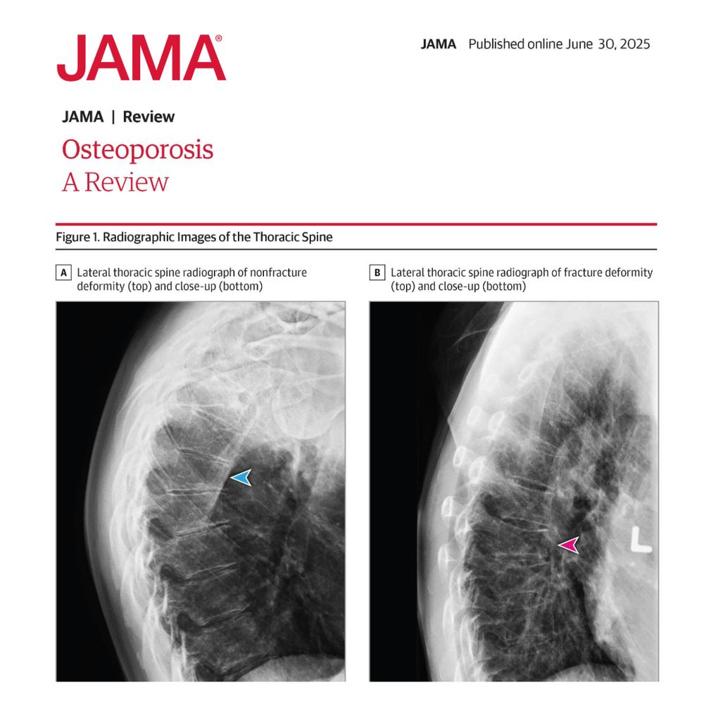 Figure 1.  Radiographic Images of the Thoracic Spine
