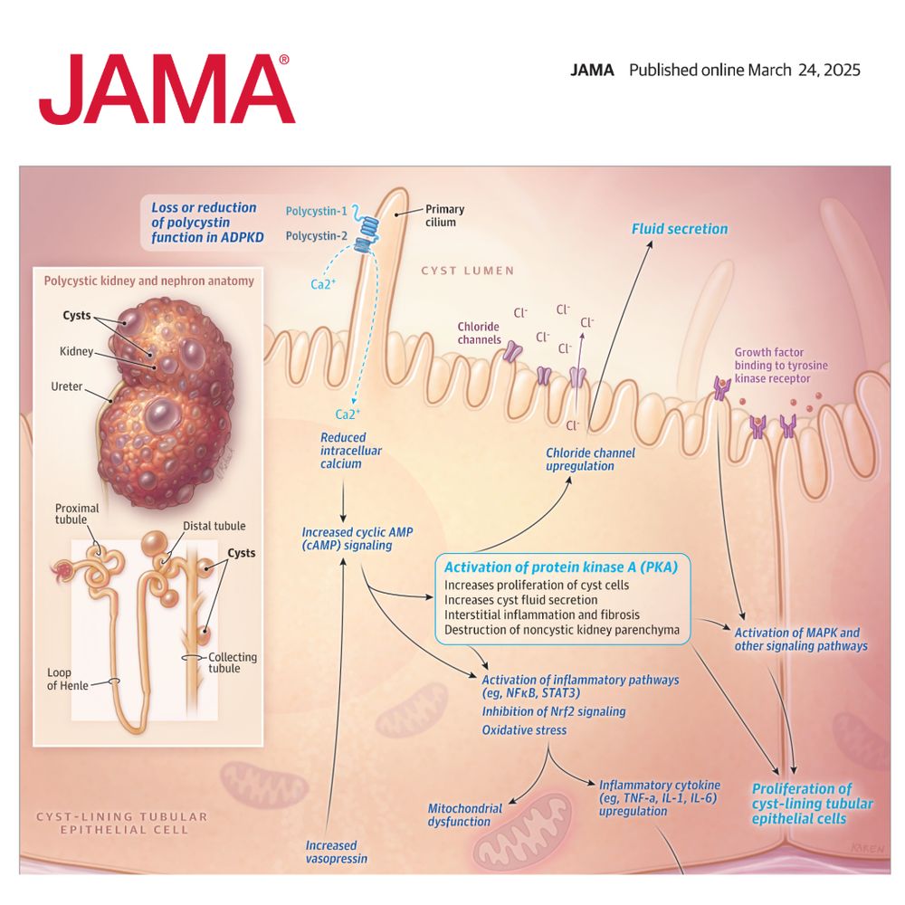 Figure 1.  Cellular Pathways in Autosomal Dominant Polycystic Kidney Disease (ADPKD) Pathogenesis
