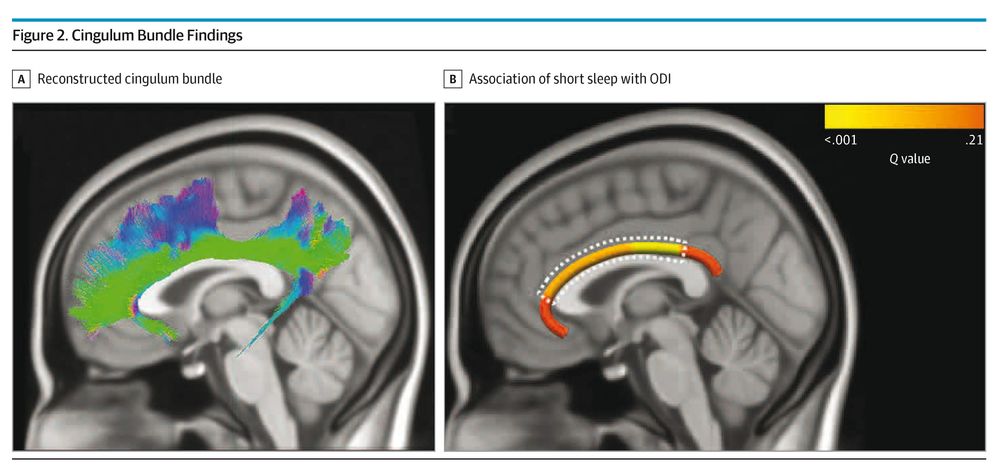 More screen time is associated with more depressive symptoms during early adolescence.