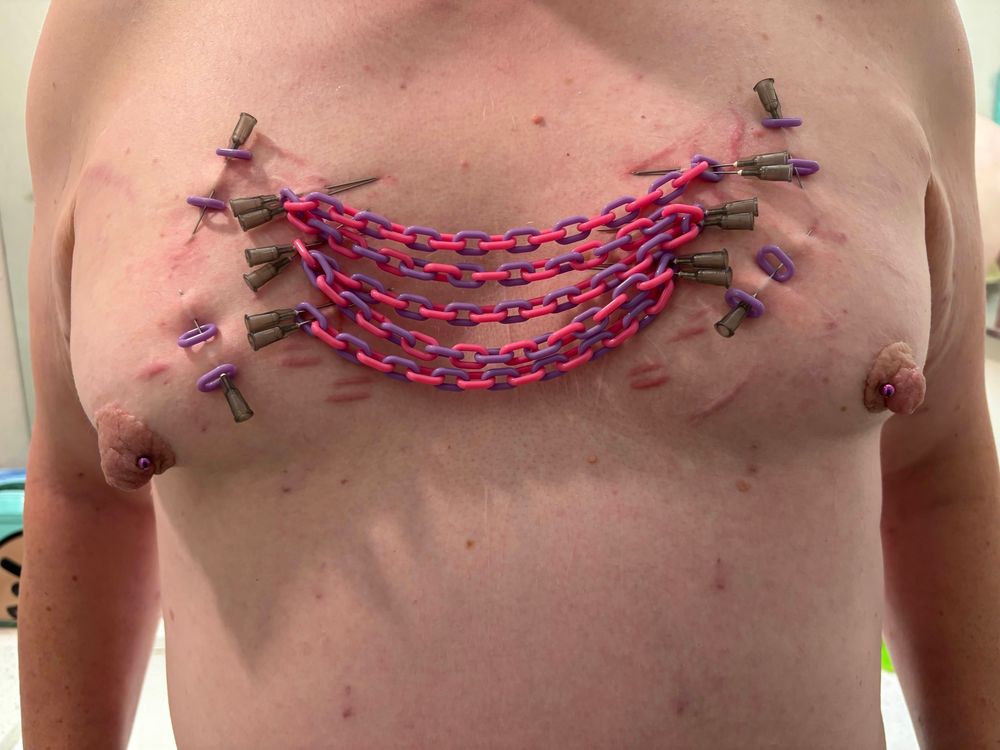 A small plastic chain made of pink and blue links is corseted across my tits with two sets of three needles on each side, there are also two needles that are double traversed on each tit with two purple chain lengths 
