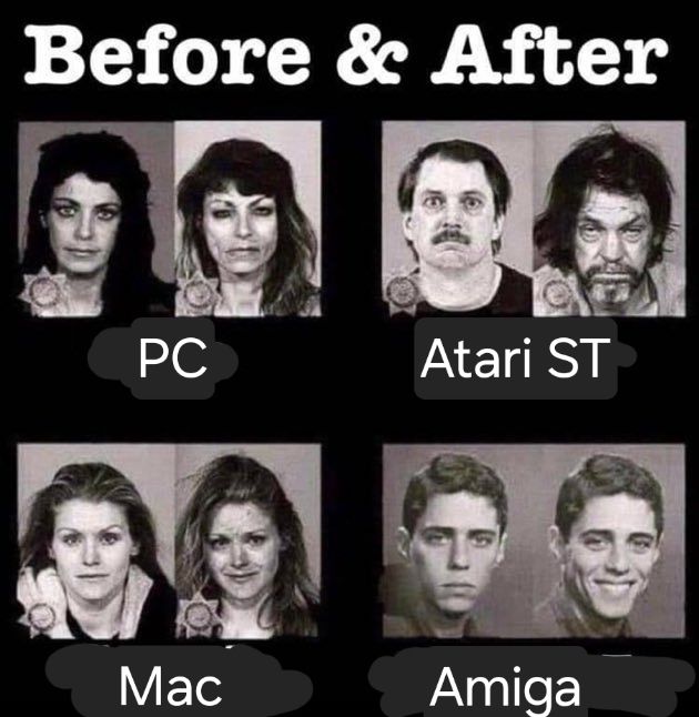 An image warning of the dangers of using different computer systems. The before and after photos for the PC, Atari ST and Mac users show them looking physically harmed. The Amiga user looks a lot happier after using the Amiga.