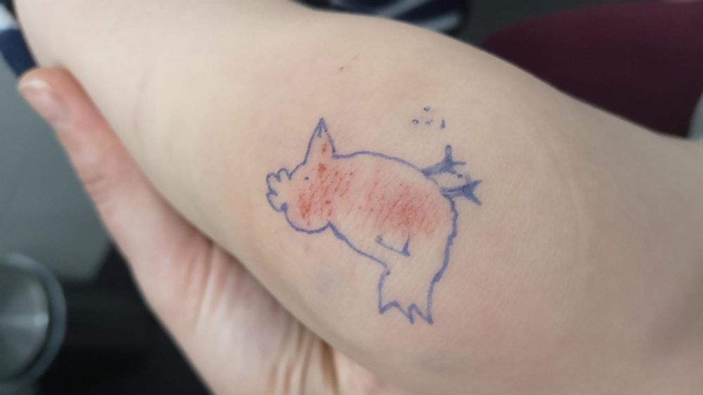 Quand on a pris le bain on a dit ciao lapinou. Pour que son départ soit mieux accepté, le 🐵 a demandé une poule à la place. Donc voici la même egratignure sur genou de 🐵 entourée d'une silhouette de poule au stylo bleu effaçable. On lui a mis des graines à picorer parce qu'on n'est pas des bêtes. Vivement le prochain bain. 