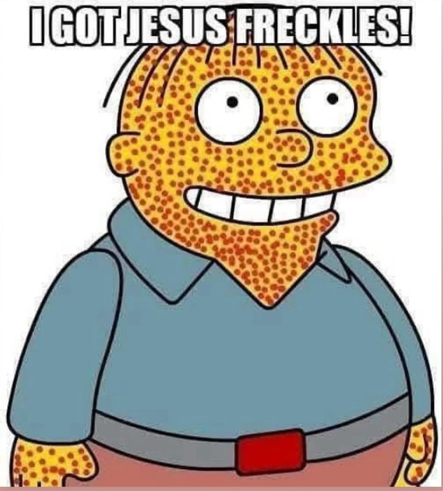 I’ve got Jesus freckles!
(Measles)