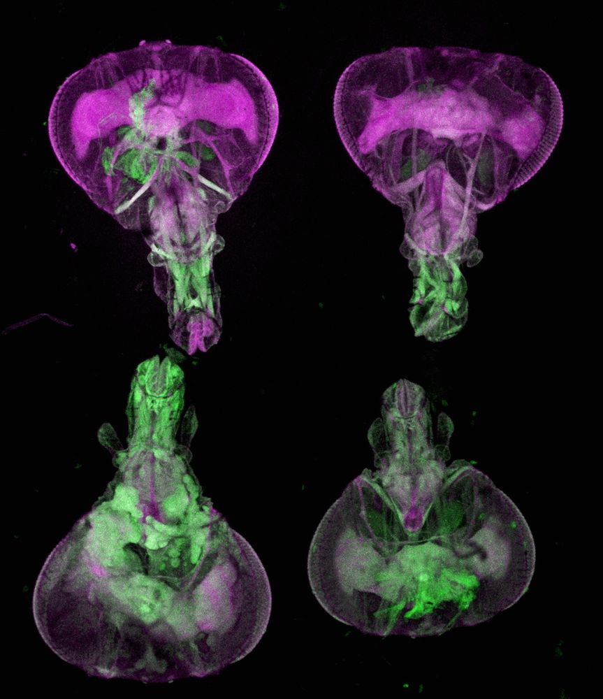 Microscopic view of 4 arranged fly heads. Exoskeletons is cleared, allowing view of the central nervous system beneath. Tissue is stained in green and purple.
