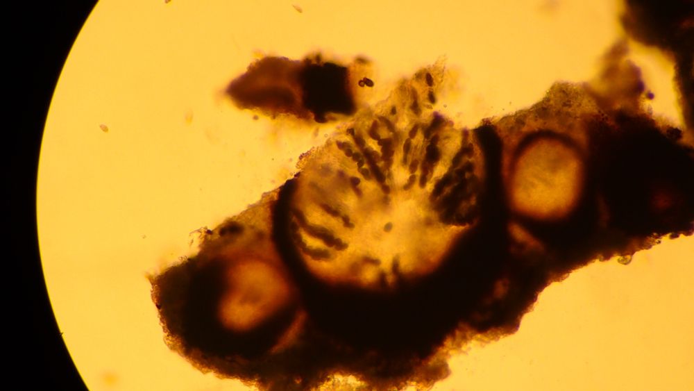 Polycoccum trypethelioides perithecium section with 8 brown spores in each ascus
