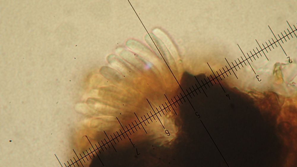 possible bryophilous fungus - asci