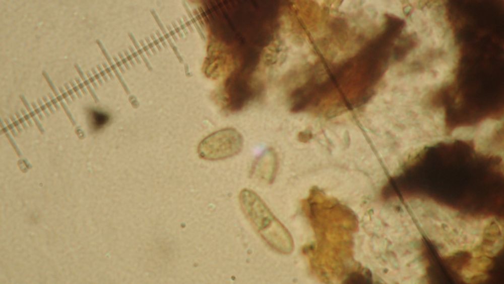 possible bryophilous fungus - 1-septate spores around 20x6.5μm