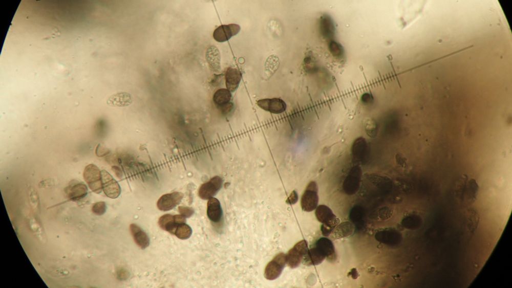 Polycoccum trypethelioides brown 1-septate spores