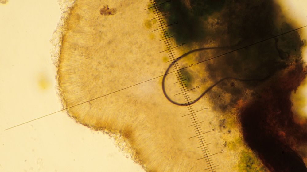 Micarea adnata apothecium section colourless