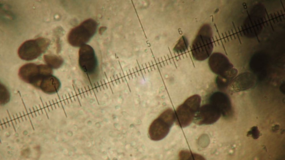 Polycoccum trypethelioides brown 1-septate spores, with lower cell smaller