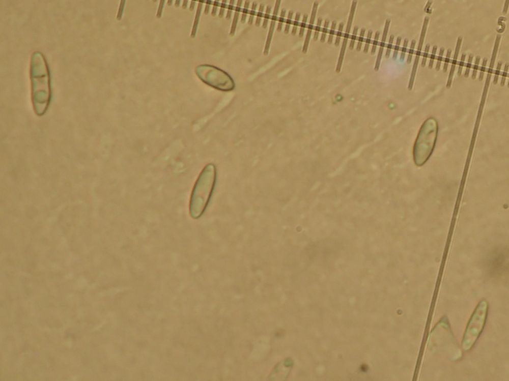 Micarea adnata spores: small with one just about visible as being one septate ie ignore the oil blobs