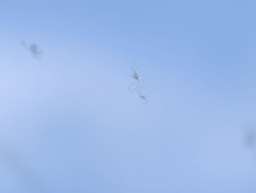 Myodésopsie, ou "avoir des corps flottants dans l'œil en permanence".