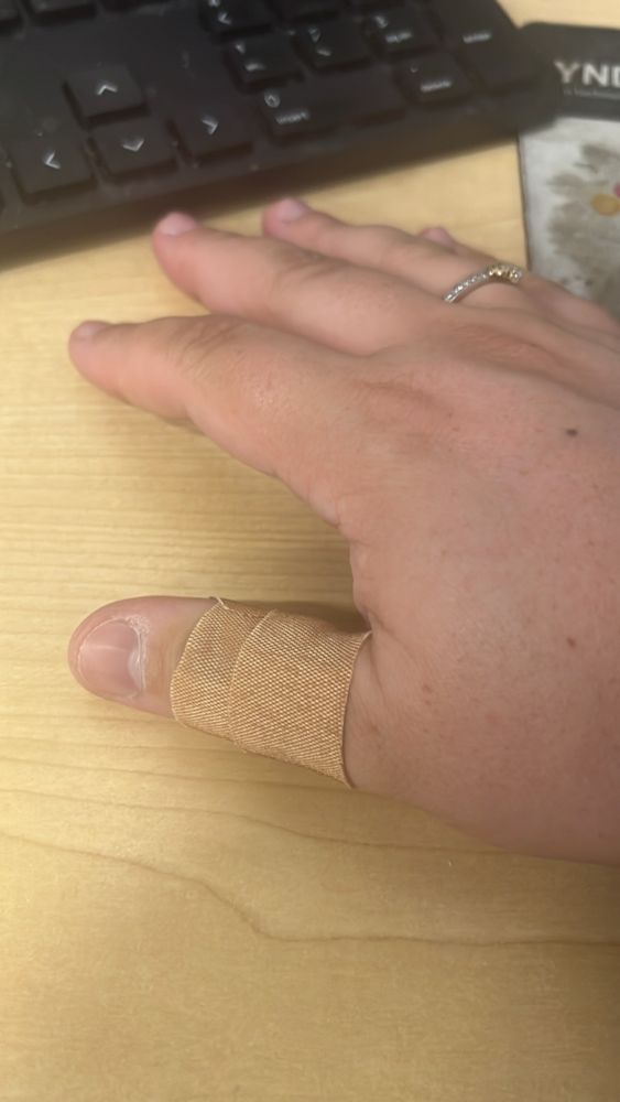my hand with bandaid on the thumb cause i’m dumb