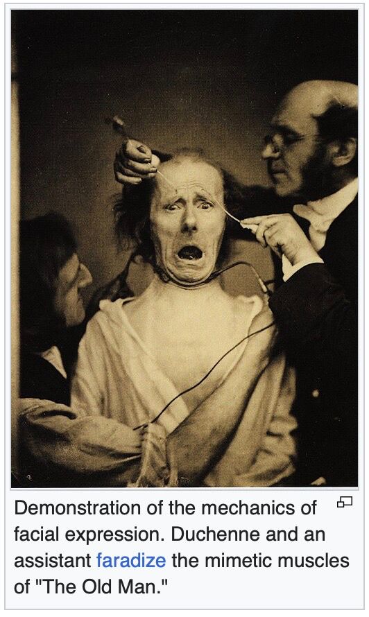 Demonstration of the mechanics of facial expression. Duchenne and an assistant faradize the mimetic muscles of "The Old Man."