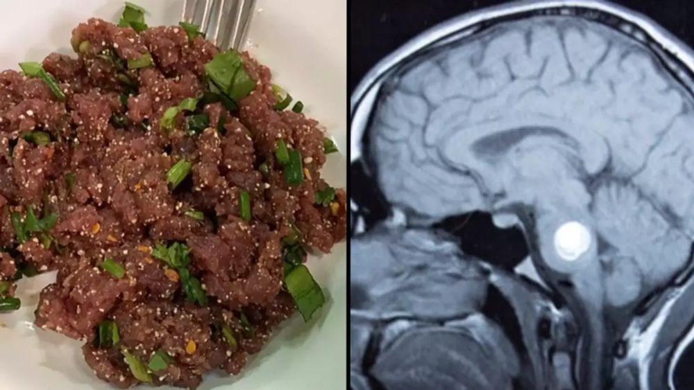 Single bite of Thai dish can give you liver cancer