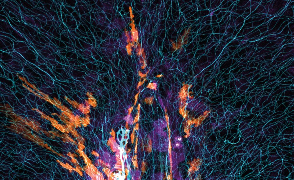 The image shows the tail fin of a genetically modified zebrafish larva (~200 x 200 microns). Peripheral nerve fibres are labelled in cyan, fibroblasts in orange & magenta. 