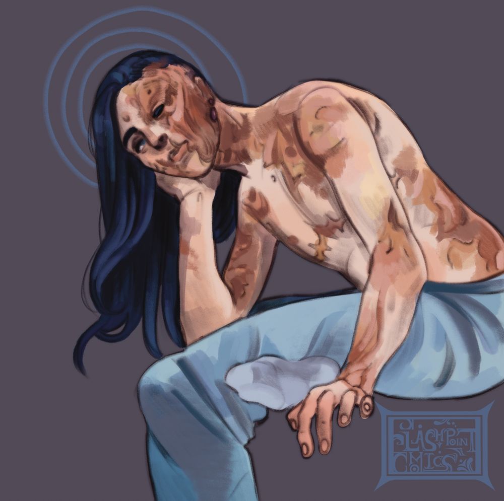 a man with long black hair and extensive burn scars leaning forward with his elbow on his knee
