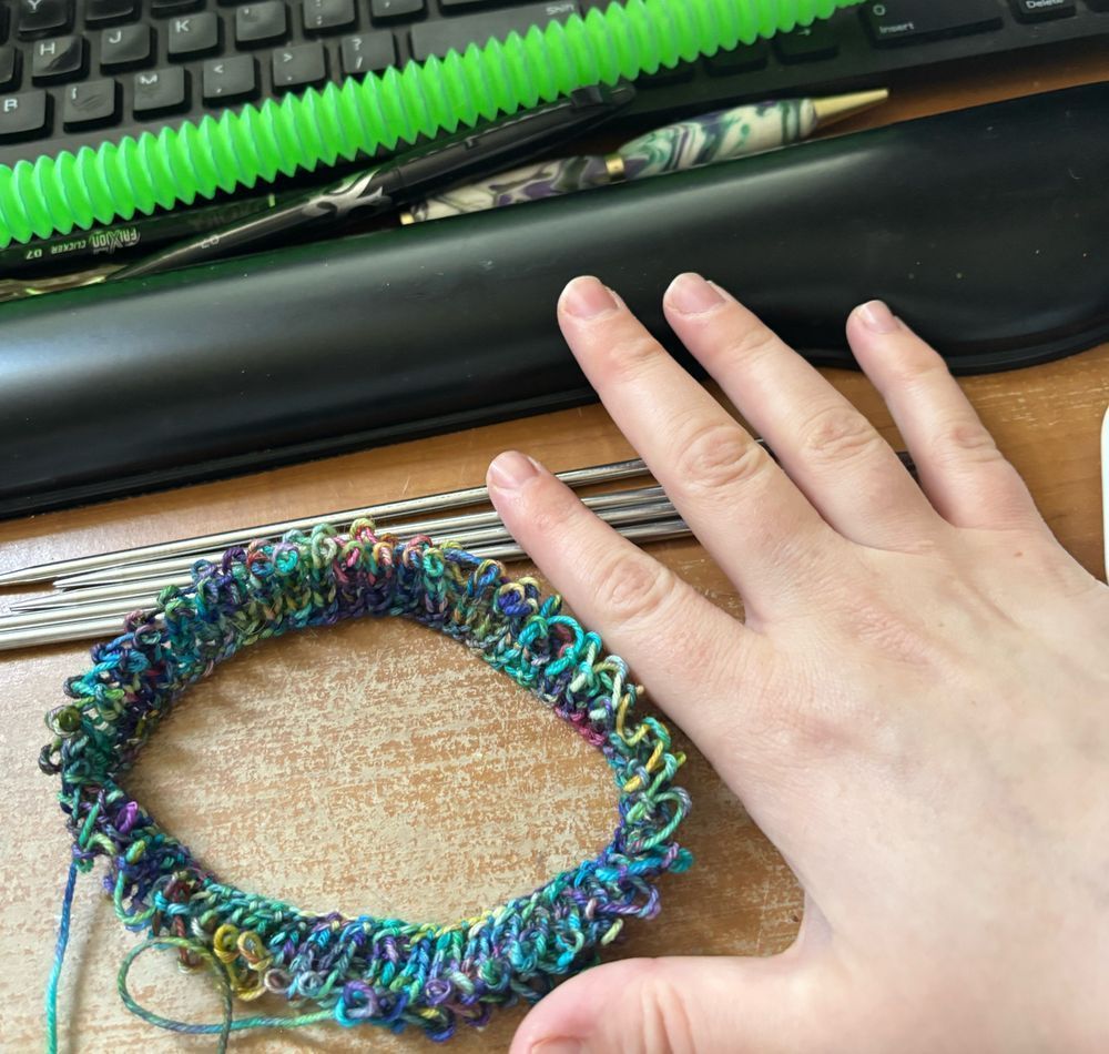 A knitting project pulled off the needles. The project was a circle of ribbing, about the size of the palm of the hand posed next to it.