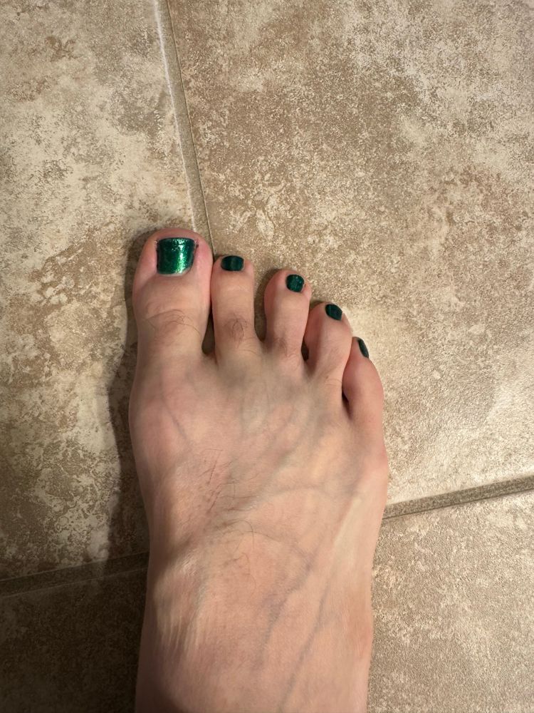 Toenails painted dark green 