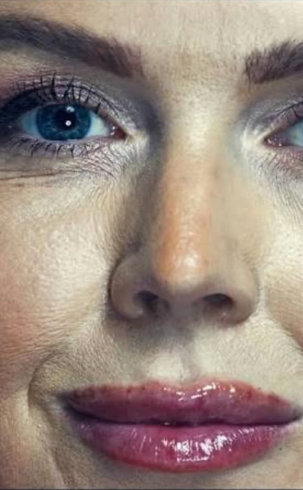 Karoline Leavitt’s wrinkly face and lip injections 