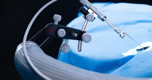 Consultant otolaryngologist and surgeon Emma Stapleton used OTODRIVE and OTOARM, developed collaboratively by hearing implant leader MED-EL and medical engineering...