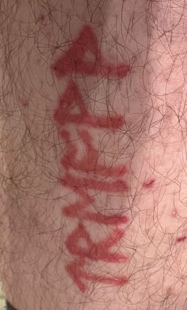 The word Treoth (as in betrothed) written in Anglo-Saxon runes tattooed in red on a leg.  This was done for our wedding. My husband has the word engrave on his wedding ring. I have the word Wyn (in runes) engraved on my ring, and he has it similarly tattooed on his leg.