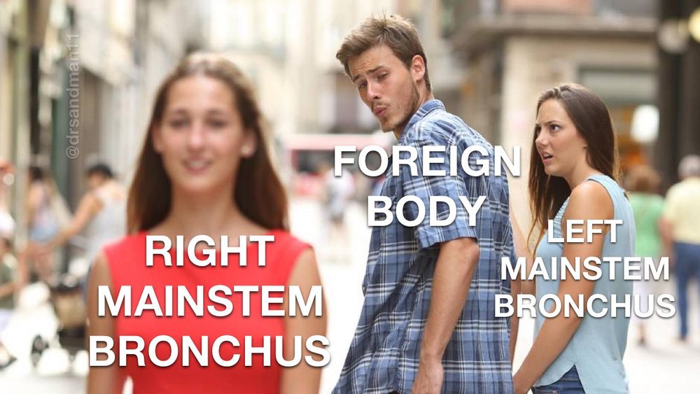 Distracted foreign body looking at the right mainstem bronchus as the left mainstem bronchus looks on offendedly 