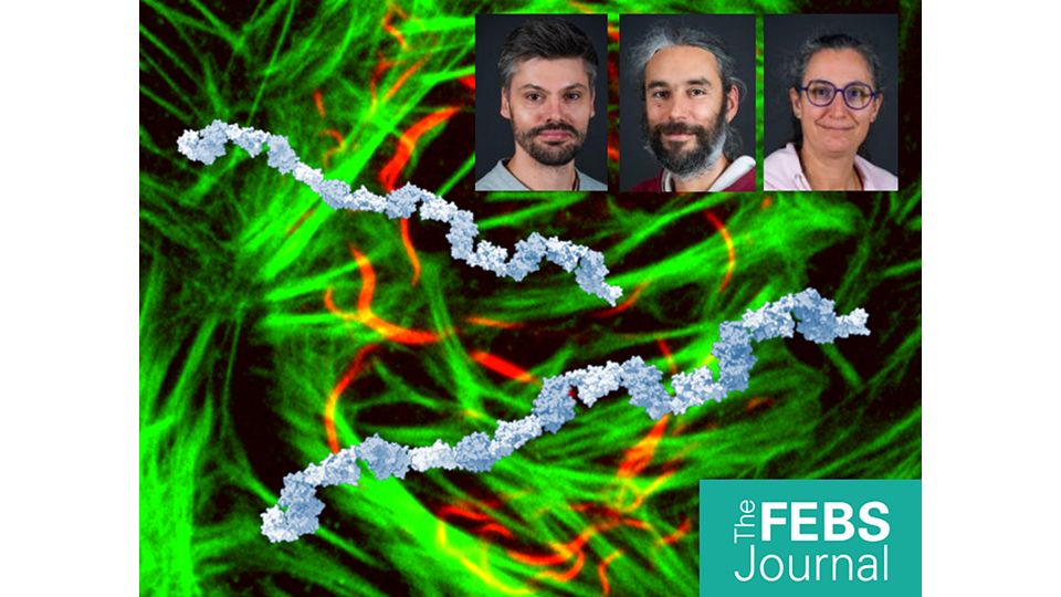 Team building among proteins: how oligomerisation of SIAH1 promotes its ubiquitin ligase activity.

By describing how SIAH1 forms polymers within cells, a collaborative work by the Huet group at IGDR and the Suskiewicz team at CBM, improves our understanding of the mechanisms by which protein aggregates involved in certain neurodegenerative diseases get cleared by the cells.