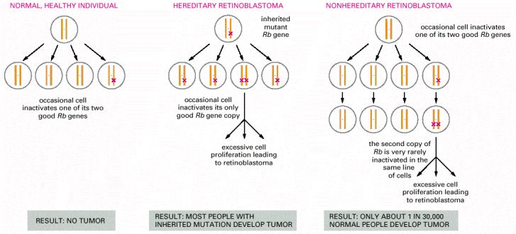 Diagram illustrating the two-hit model of retinoblastoma