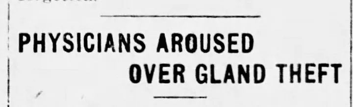 Headline reads "Physicians Aroused Over Gland Theft"
