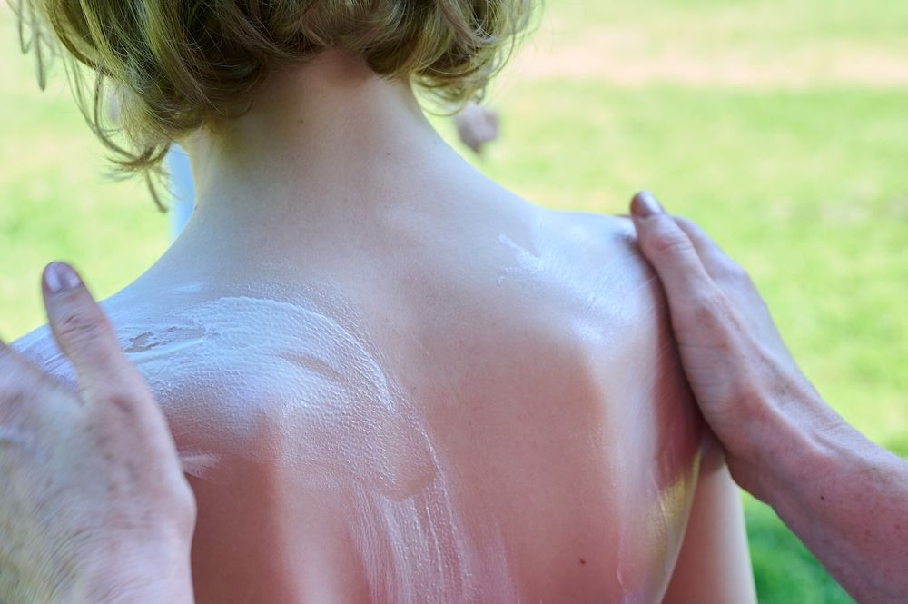 A growing anti-sunscreen movement on social media is causing concern among dermatologists, who warn that avoiding sunscreen increases long-term health risks.