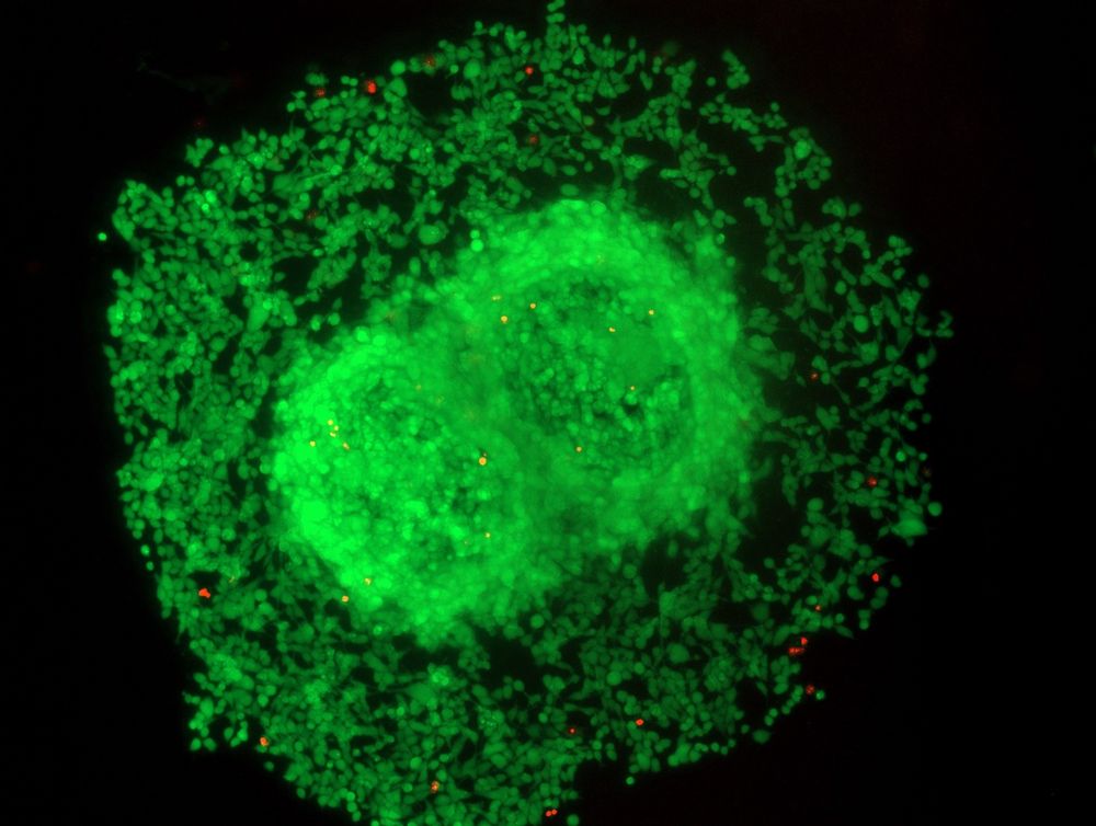 A fusion of two tumor spheroids within a hydrogel, observed using fluorescence microscopy