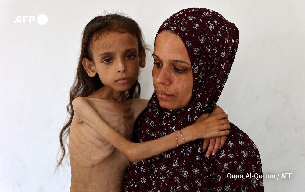 Nine-year-old malnourished Palestinian girl Mariam Dawwas is carried by her mother in the Rimal neighbourhood in Gaza City on August 2, 2025