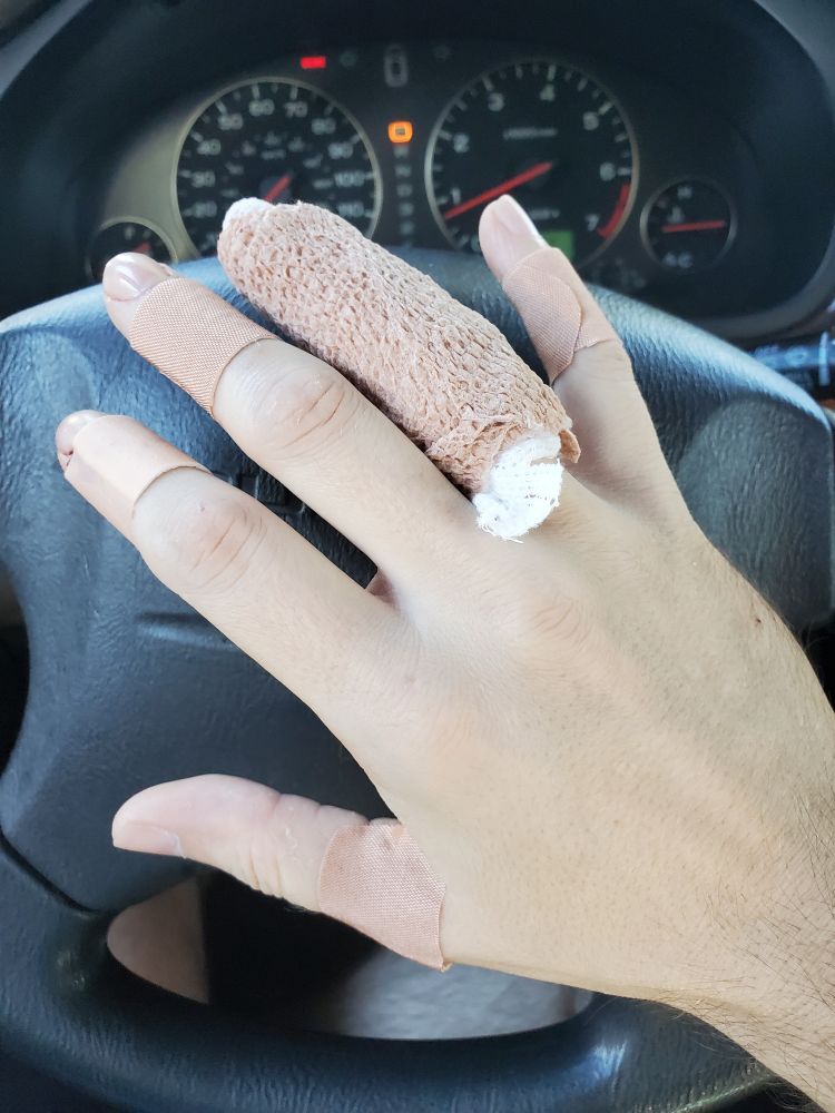 My right hand, with every finger bandaged except my ring finger, which is gauzed 