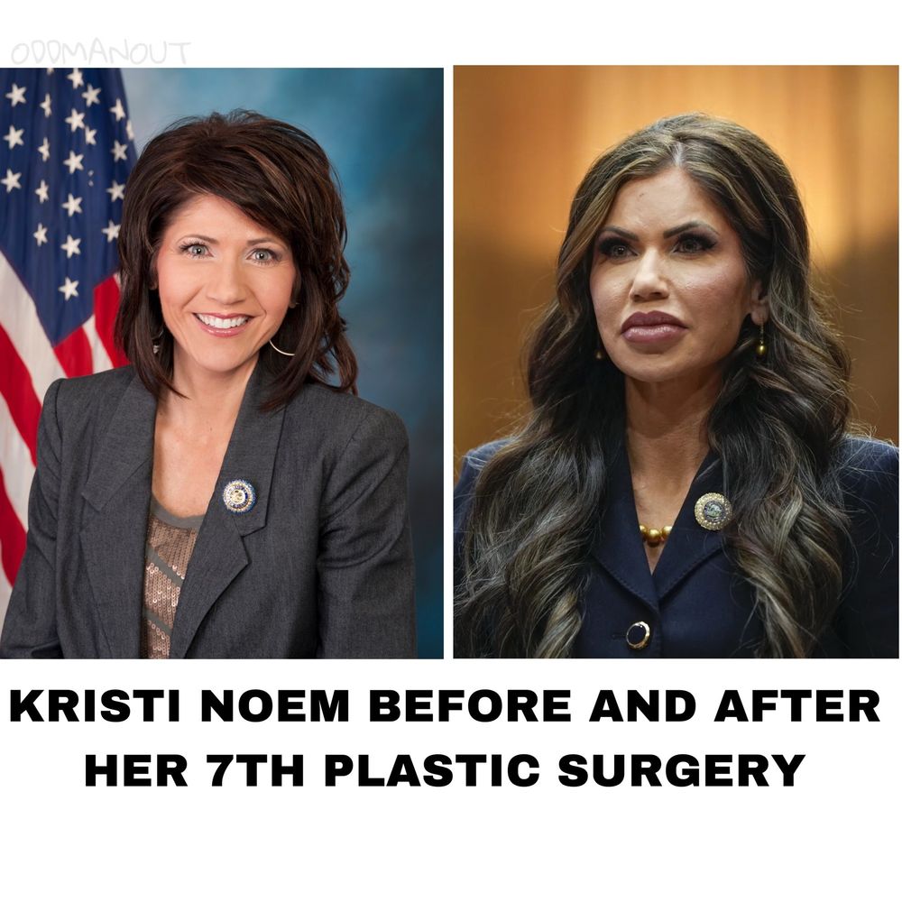 Kristi Noem before and after! 