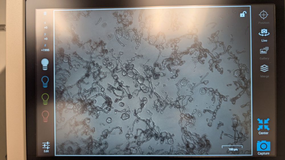 Neurons in a dish 