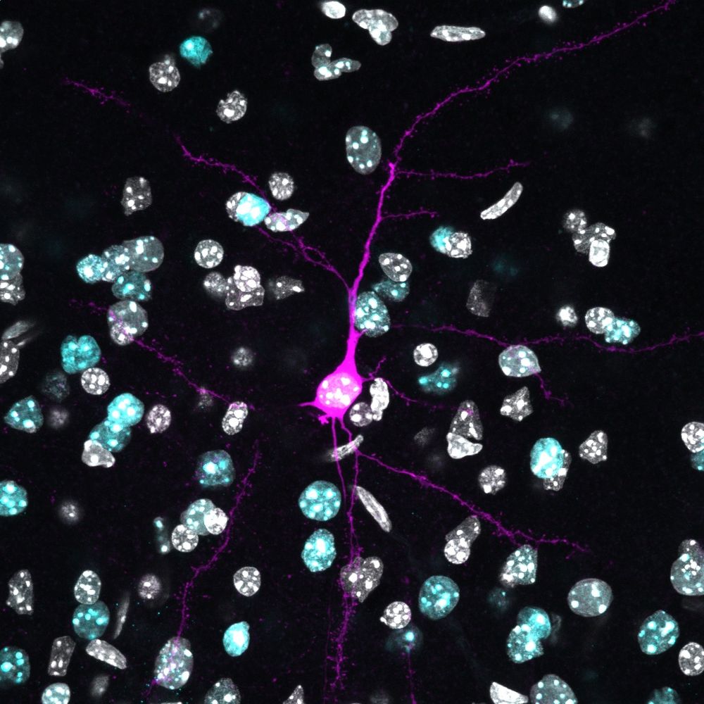 Fluorescence microscopy image of a neuron.