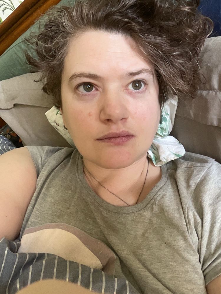 A pale-skinned nonbinary person lying in bed with an ice pack in a patterned pillow case behind their head, propped up on pillows. They have short dark haired sticking up and are wearing a grey sloth pyjama top. They look pale and unwell and have dark circles under their hazel eyes
