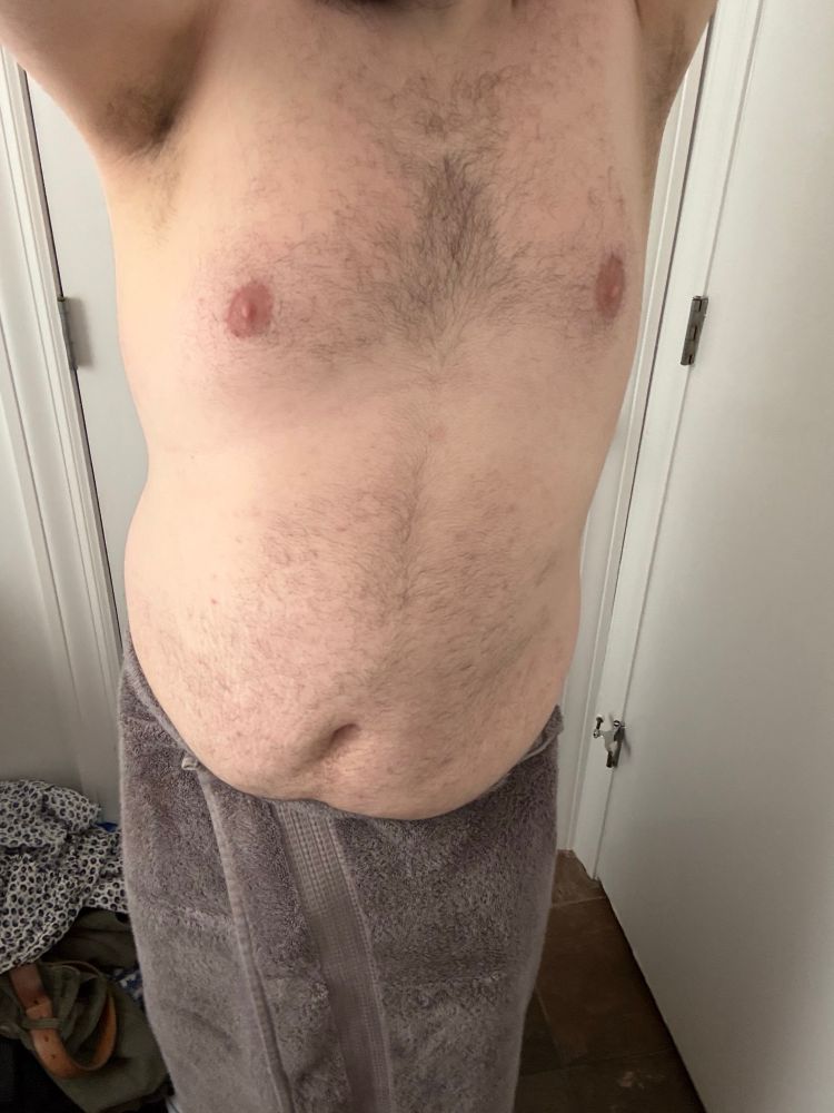 A picture of Blue from the neck down showing off belly and chest. Wearing a towel from the waist down 