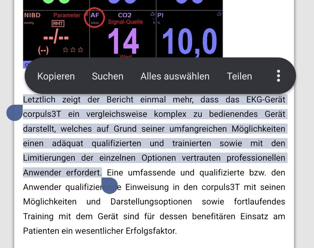 Letztlich zeigt der Bericht einmal mehr, dass das EKG-Gerät corpuls3T ein vergleichsweise komplex zu bedienendes Gerät darstellt, welches auf Grund seiner umfangreichen Möglichkeiten einen adäquat qualifizierten und trainierten sowie mit den Limitierungen der einzelnen Optionen vertrauten professionellen Anwender erfordert.