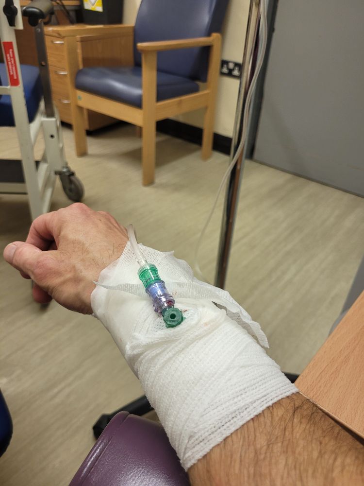 A canulated right arm.