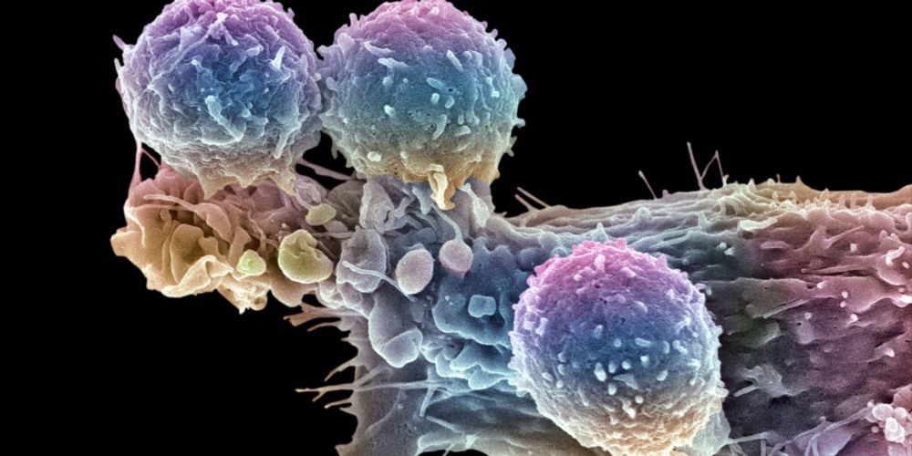 The effort to make a breakthrough cancer therapy cheaper