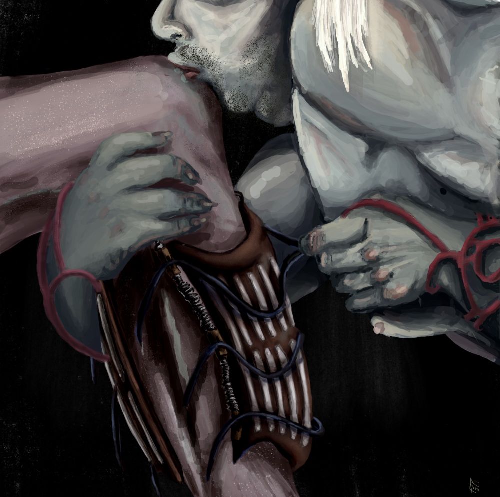 a quanri kissing thier disbaled love
focused and removing their supprot splint