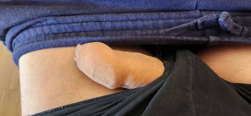 Top down shot of a person with their pants at their knees and a thick, semi-erect, and uncircumcised penis oushing out of the leg hole of their underwear