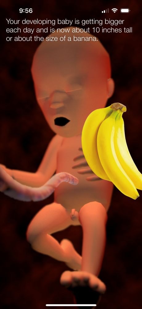 Image from a pregnancy app of a fetus next to a banana with text describing “your developing baby” as “about the size of a banana”