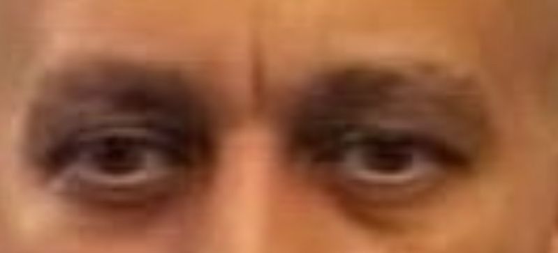 Deadass eyes of Jefferies